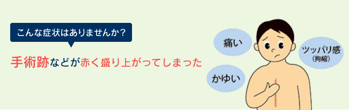 こんな症状はありませんか？ 手術跡などが赤く盛り上がってしまった